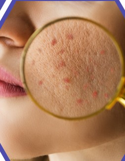 Dermatologist Doctor Sylhet