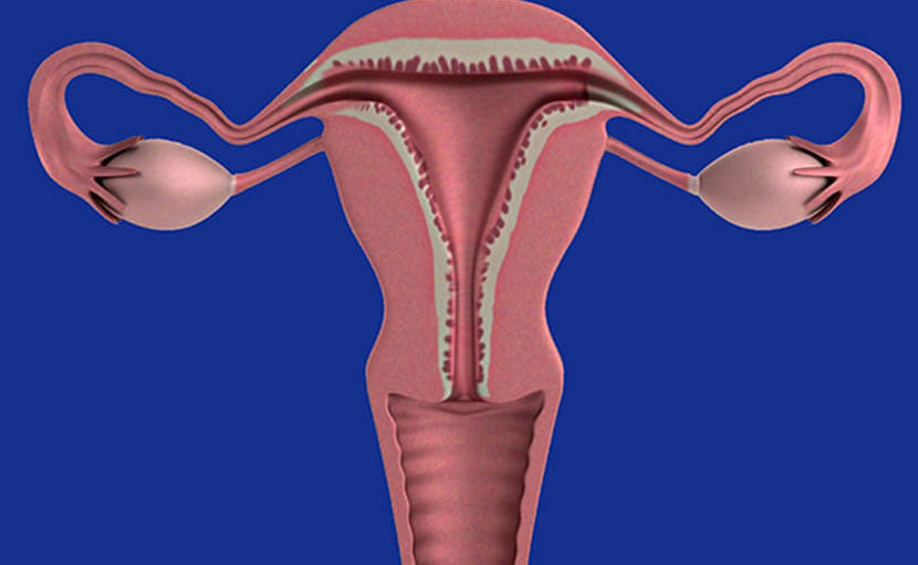সাদা স্রাব | লিউকোরিয়ার কারণ রোগ নির্ণয় ও চিকিৎসা কী?