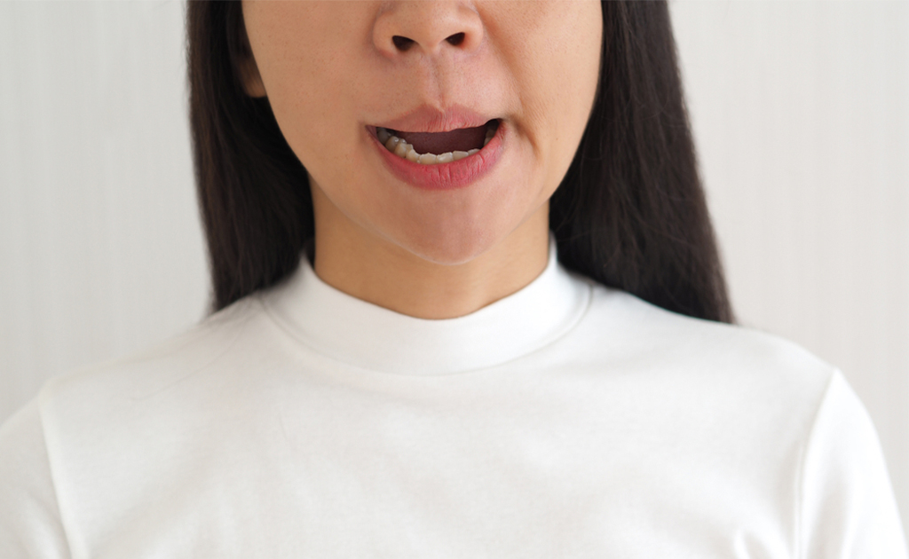 ফেসিয়াল নার্ভ প্যারালাইসিস বা হঠাৎ মুখ বেঁকে যাওয়ার কারণ ও চিকিৎসা