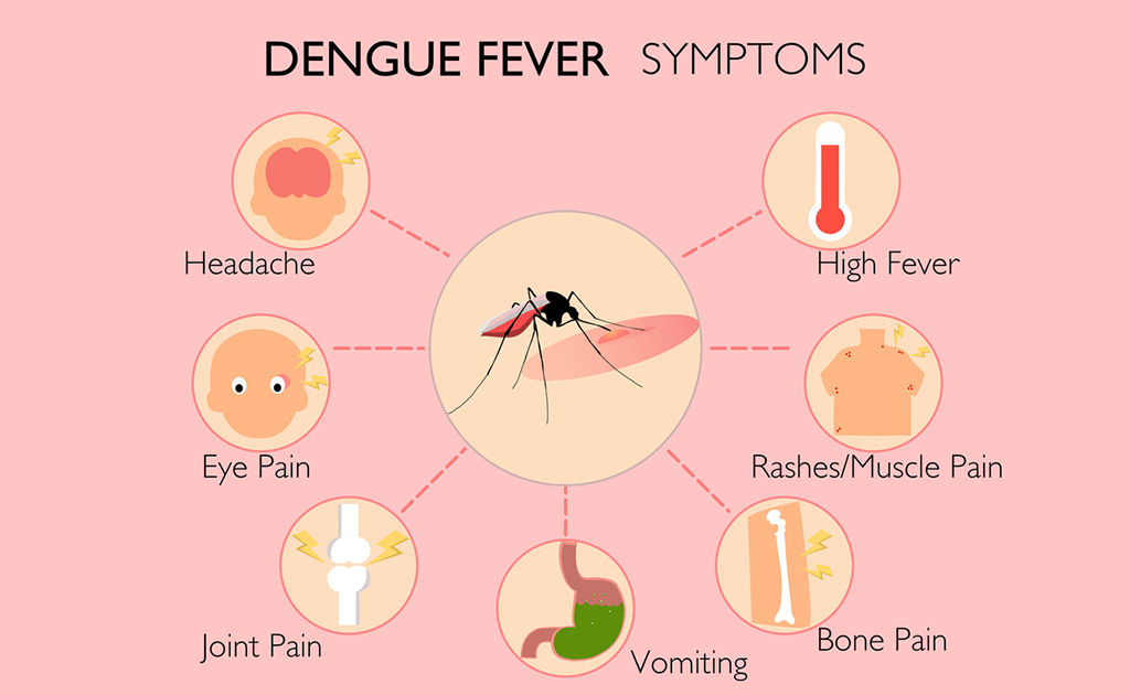 ডেঙ্গুতে আক্রান্ত হয়েছেন কিনা কোন লক্ষণগুলো দেখে বুঝবেন?