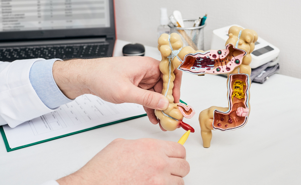 অ্যাপেন্ডিসাইটিস এর কারণে পেটে ব্যথা হচ্ছে না তো?