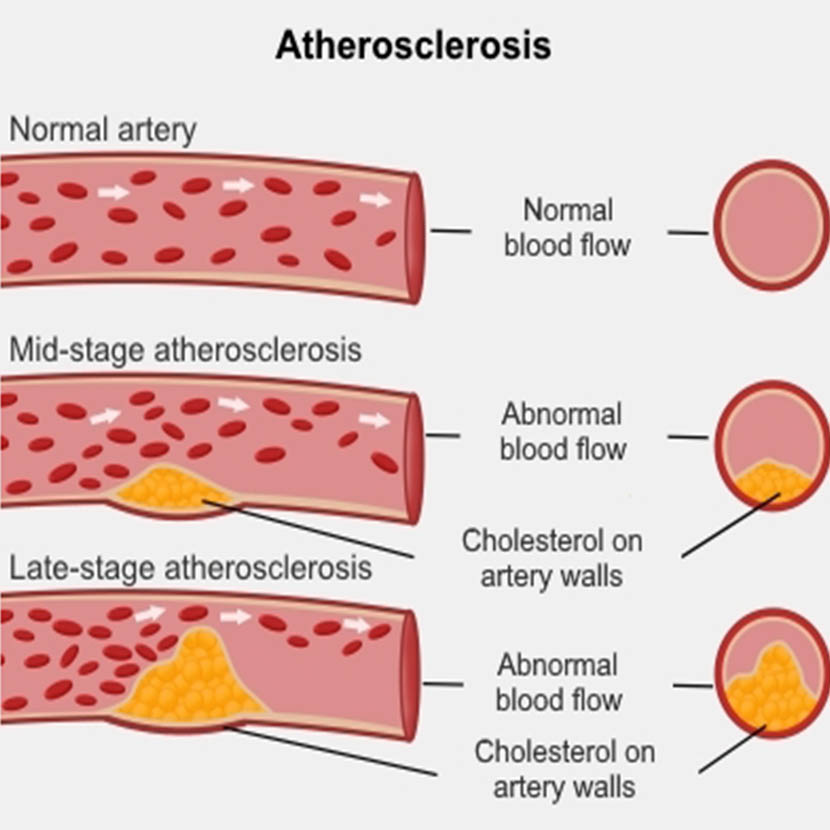 দেহের চাহিদা পূরণে খেজুর | জেনে নিন ৭টি উপকারিতা